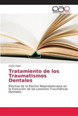 Traitement des traumatismes dentaires - Tratamiento de los Traumatismos Dentales
