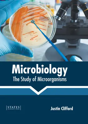 La microbiologie : L'étude des micro-organismes - Microbiology: The Study of Microorganisms