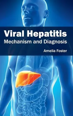 L'hépatite virale : Mécanisme et diagnostic - Viral Hepatitis: Mechanism and Diagnosis