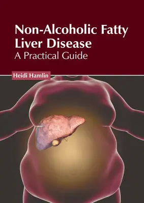 La maladie du foie gras non alcoolique : Un guide pratique - Non-Alcoholic Fatty Liver Disease: A Practical Guide