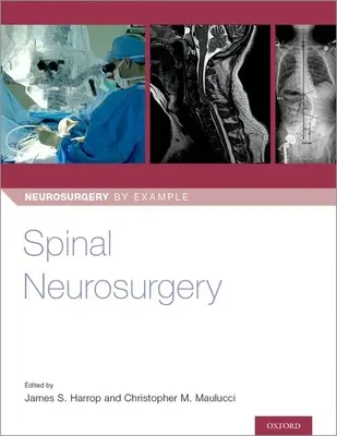 Neurochirurgie spinale - Spinal Neurosurgery