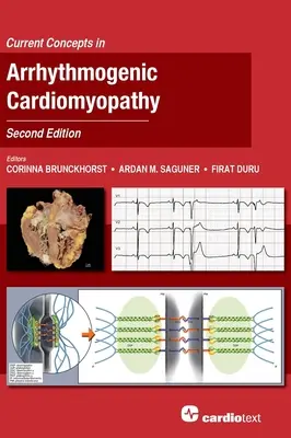 Concepts actuels de la cardiomyopathie arythmogène, deuxième édition - Current Concepts in Arrhythmogenic Cardiomyopathy, Second Edition