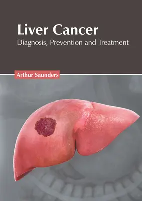 Cancer du foie : Diagnostic, prévention et traitement - Liver Cancer: Diagnosis, Prevention and Treatment