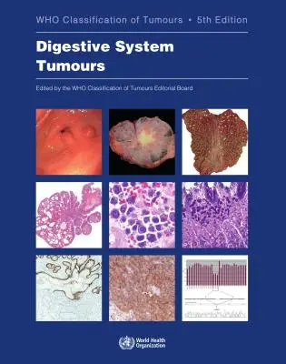 Tumeurs de l'appareil digestif : Classification des tumeurs par l'OMS - Digestive System Tumours: Who Classification of Tumours