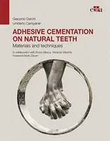 Cimentation adhésive sur dents naturelles - Matériaux et techniques - Adhesive cementation on natural teeth - Materials and techniques