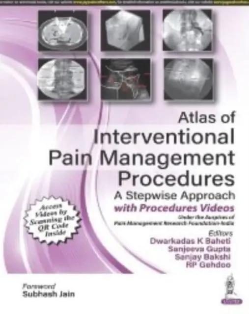 Atlas des procédures interventionnelles de gestion de la douleur - Atlas of Interventional Pain Management Procedures