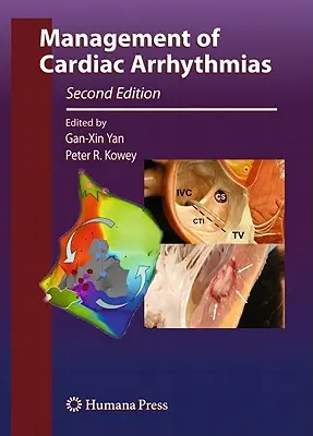 Gestion des arythmies cardiaques - Management of Cardiac Arrhythmias
