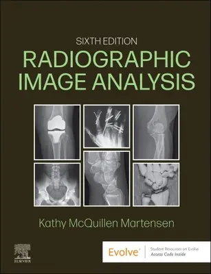 Analyse des images radiographiques - Radiographic Image Analysis