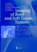 Imagerie des tumeurs osseuses et des tissus mous : Une approche par étude de cas - Imaging of Bone and Soft Tissue Tumors: A Case Study Approach
