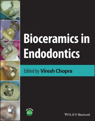 Les biocéramiques en endodontie - Bioceramics in Endodontics