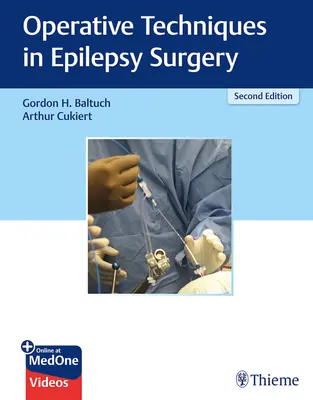 Techniques opératoires en chirurgie de l'épilepsie - Operative Techniques in Epilepsy Surgery