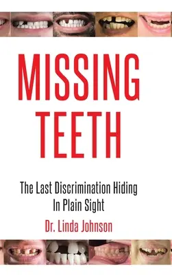 Dents manquantes : La dernière discrimination cachée à la vue de tous - Missing Teeth: The Last Discrimination Hiding in Plain Sight