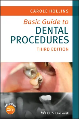 Guide de base des procédures dentaires - Basic Guide to Dental Procedures