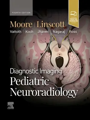 Imagerie diagnostique : Neuroradiologie pédiatrique - Diagnostic Imaging: Pediatric Neuroradiology