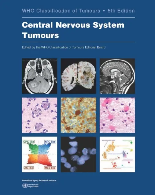 Tumeurs du système nerveux central : Classification des tumeurs par l'OMS - Central Nervous System Tumours: Who Classification of Tumours