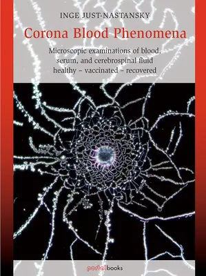 Les phénomènes sanguins de Corona : Examens microscopiques du sang, du sérum et du liquide céphalo-rachidien : Sains - Vaccinés - Récupérés - Corona Blood Phenomena: Microscopic Examinations of Blood, Serum, and Cerebrospinal Fluid: Healthy - Vaccinated - Recovered