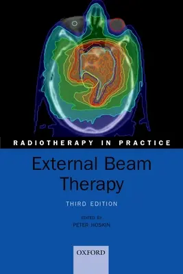 Thérapie par faisceau externe - External Beam Therapy