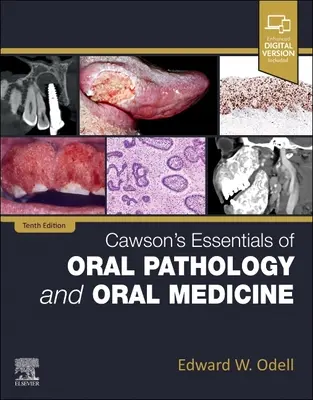 Cawson's Essentials of Oral Pathology and Oral Medicine (en anglais) - Cawson's Essentials of Oral Pathology and Oral Medicine