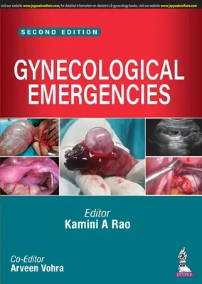 Urgences gynécologiques - Gynecological Emergencies