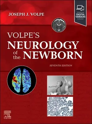 La neurologie du nouveau-né de Volpe - Volpe's Neurology of the Newborn