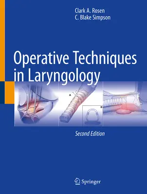 Techniques opératoires en laryngologie - Operative Techniques in Laryngology