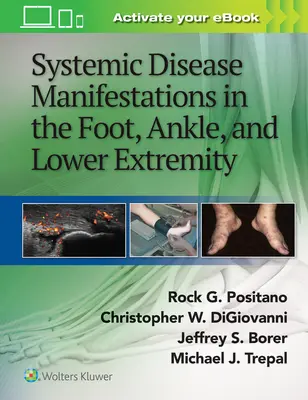 Manifestations des maladies systémiques du pied, de la cheville et des membres inférieurs - Systemic Disease Manifestations in the Foot, Ankle, and Lower Extremity