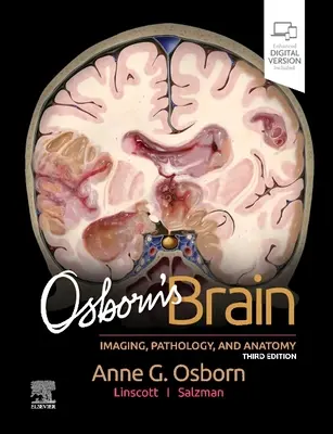 Le cerveau d'Osborn - Osborn's Brain