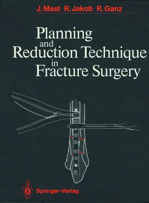 Technique de planification et de réduction en chirurgie des fractures - Planning and Reduction Technique in Fracture Surgery