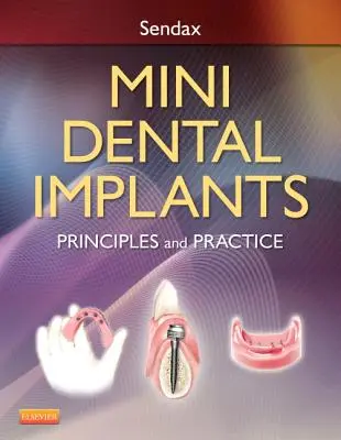 Les mini-implants dentaires : Principes et pratique - Mini Dental Implants: Principles and Practice