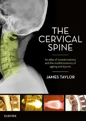 La colonne cervicale : Atlas de l'anatomie normale et de l'anatomie morbide du vieillissement et des blessures - The Cervical Spine: An Atlas of Normal Anatomy and the Morbid Anatomy of Ageing and Injuries