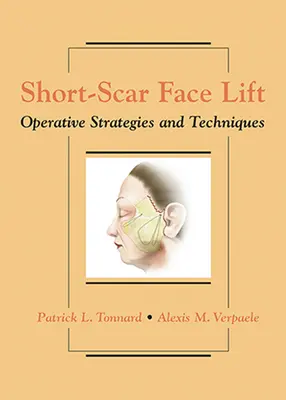Lifting du visage à cicatrice courte : Stratégies et techniques opératoires - Short-Scar Face Lift: Operative Strategies and Techniques