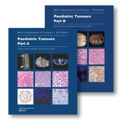 Tumeurs pédiatriques : La classification des tumeurs en pédiatrie - Paediatric Tumours: Who Classification of Tumours