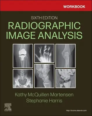 Manuel d'analyse d'images radiographiques - Workbook for Radiographic Image Analysis