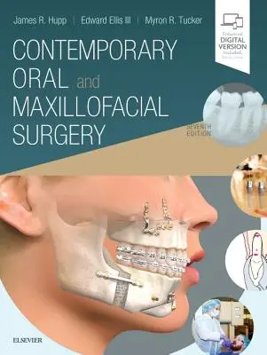 Chirurgie orale et maxillo-faciale contemporaine - Contemporary Oral and Maxillofacial Surgery